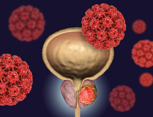 FACTORES DE RIESGO Y SÍNTOMAS DEL CÁNCER DE PRÓSTATA