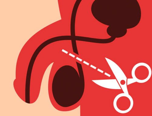 Vasectomía: preguntas clave que debes conocer antes de decidir